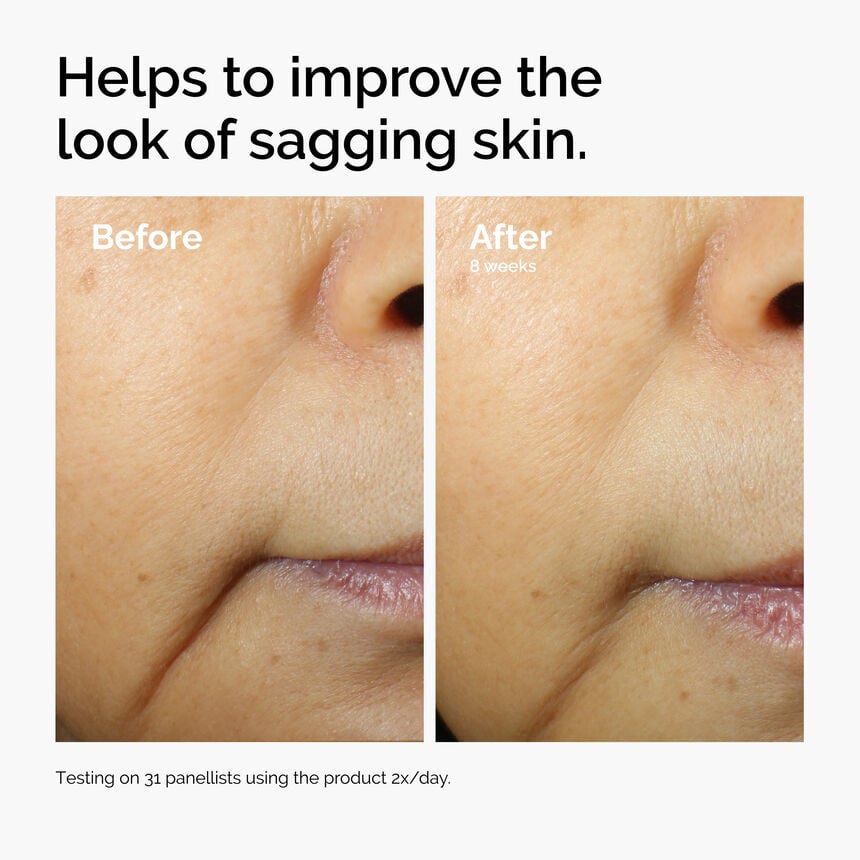 Caffeine 3% + Escin 1% Face Serum Puffiness Eye Care - Image 4