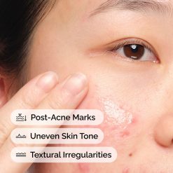 Alternative view of The INKEY Skin Aloe 2% + NAG 2% Solution