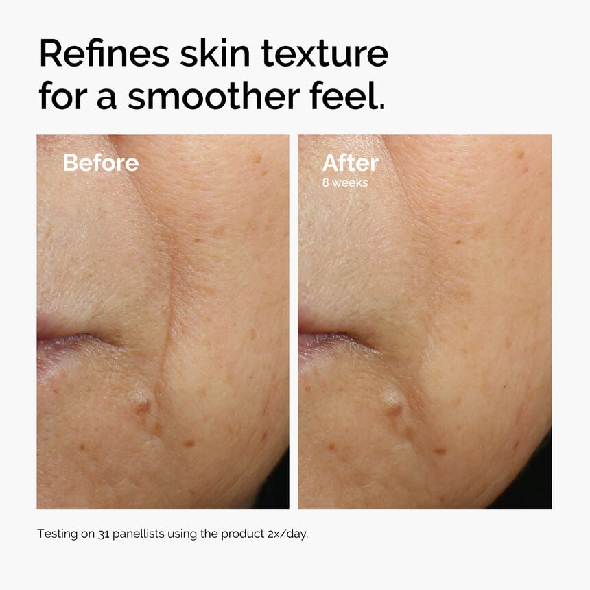 Caffeine 3% + Escin 1% Face Serum Puffiness Eye Care - Image 3