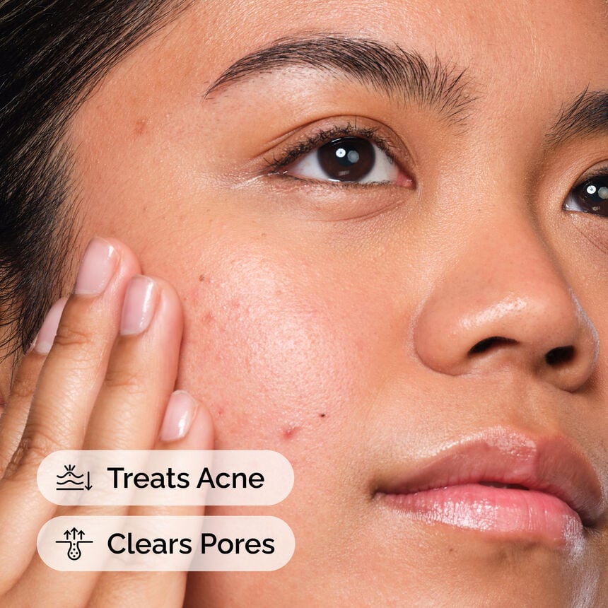 Salicylic Acid 2% Solution Acne Pore Face Serum - Image 5