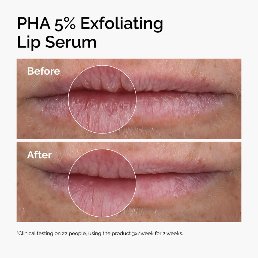 The INKEY Skin PHA 5% Exfoliating Lip Serum - Image 4