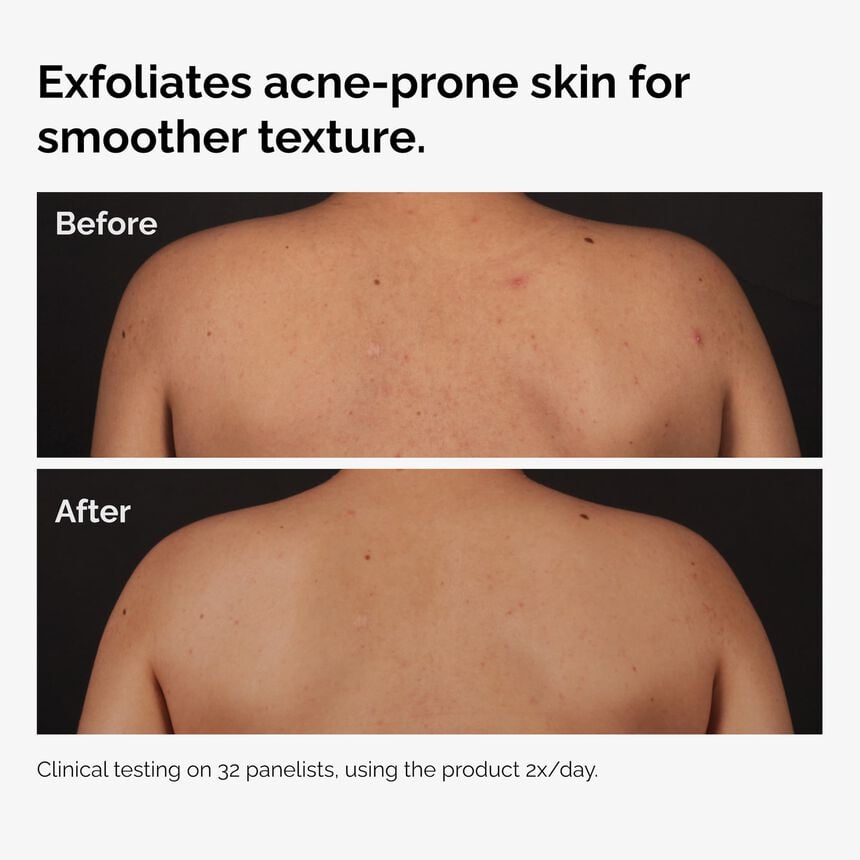 The Ordinary New Arrival The Body Care Collection - Image 5