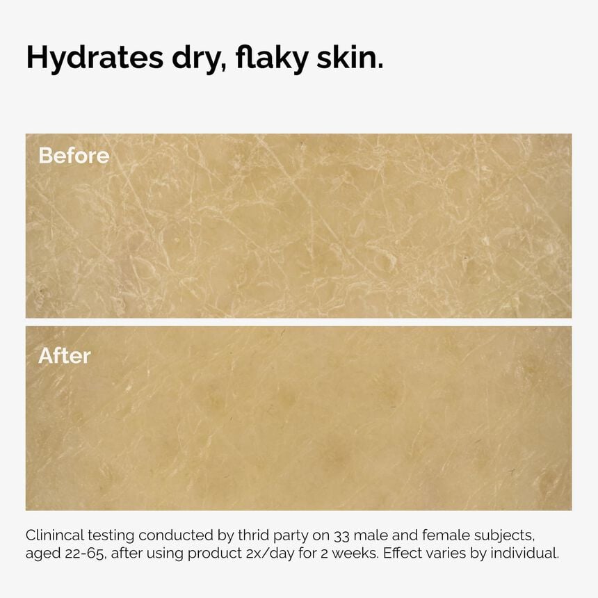 The Ordinary New Arrival The Body Care Collection - Image 9